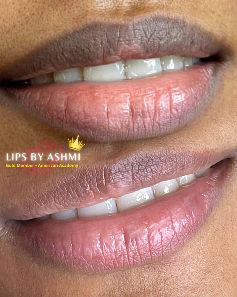 permanent lip blush treatment