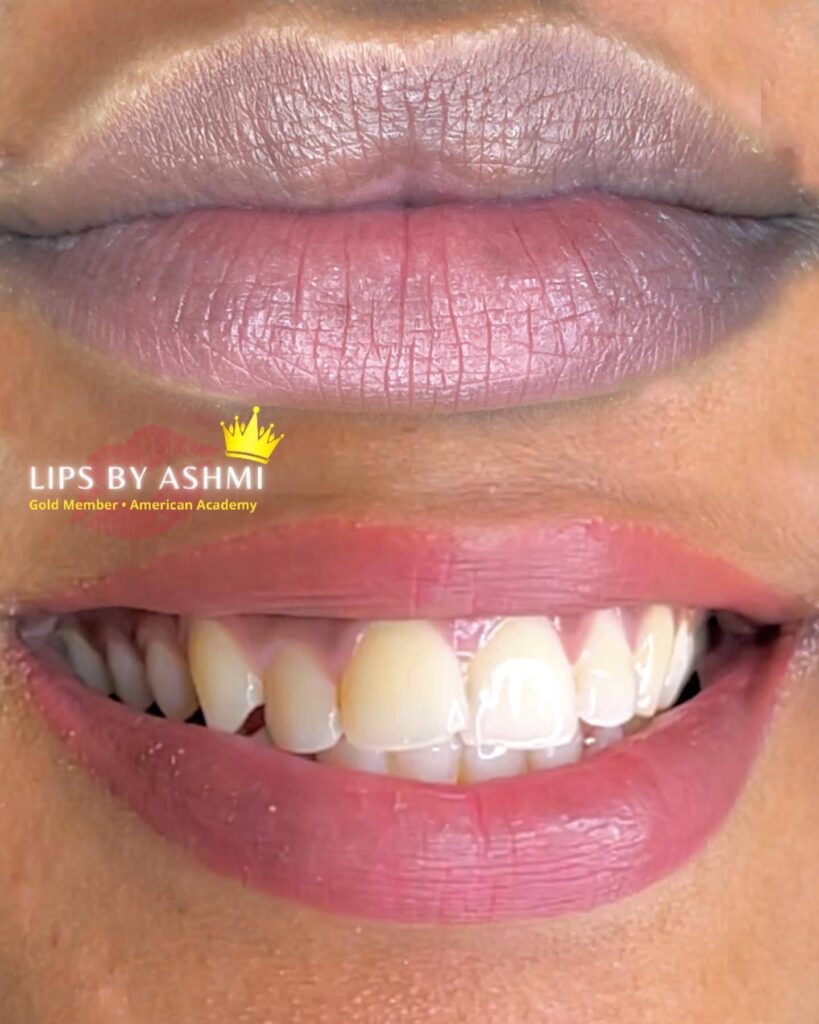 lip blushing treatment in Bangalore