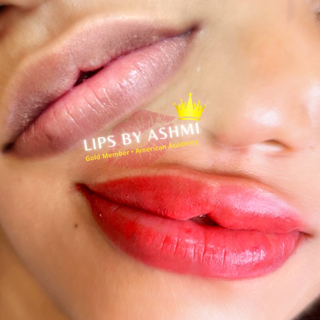 lip blushing treatment in Ahmedabad