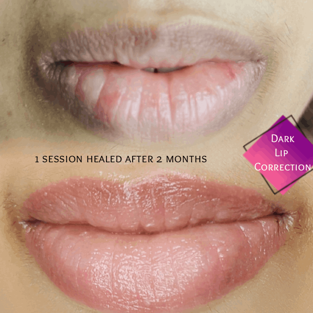 lip blushing treatment in Kerala