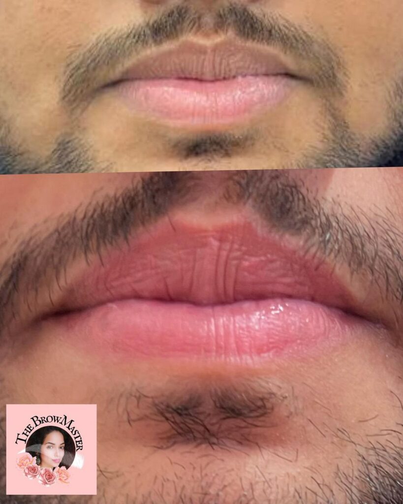 lip blushing treatment in mizoram