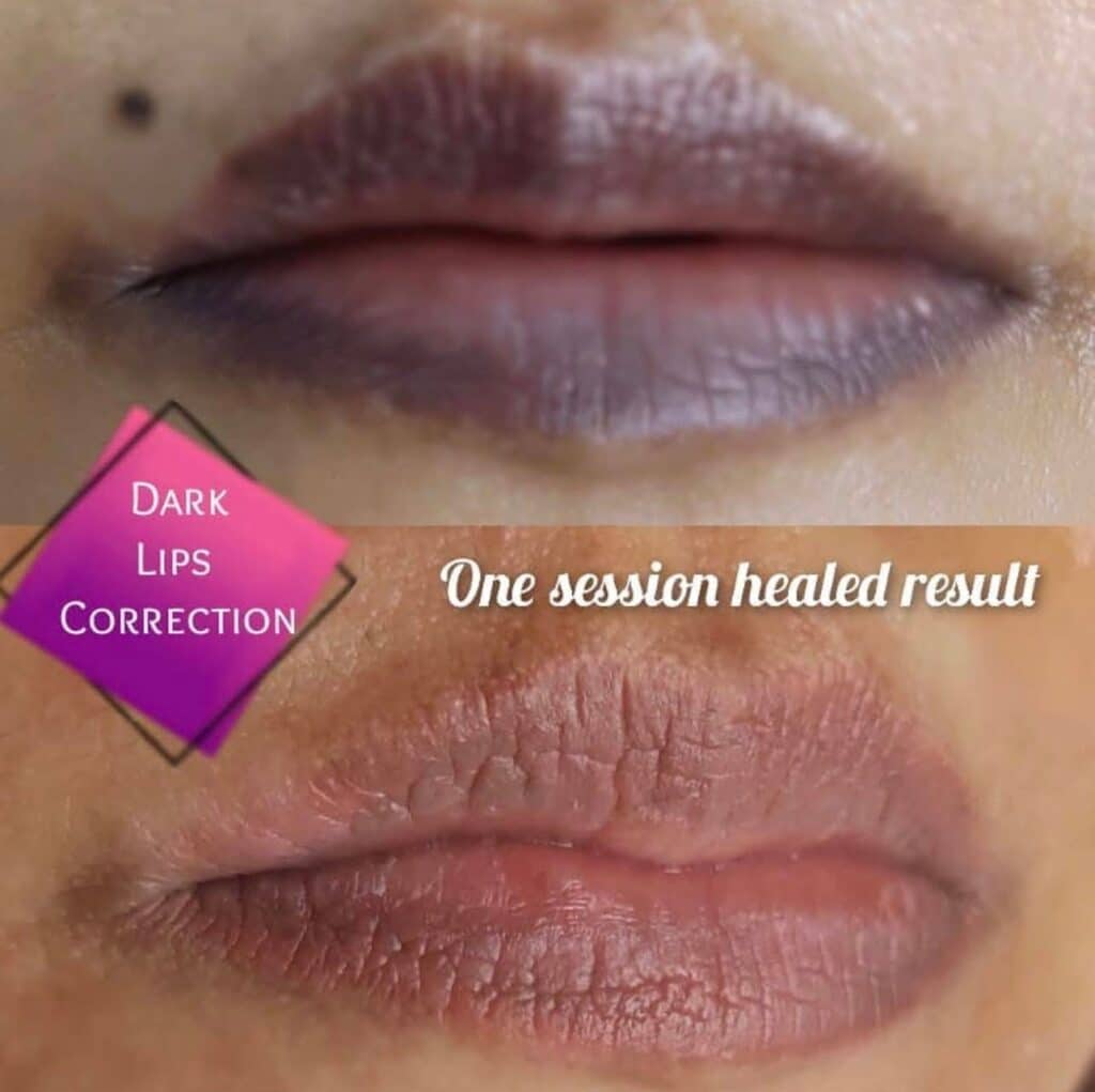 lip blushing treatment in pune