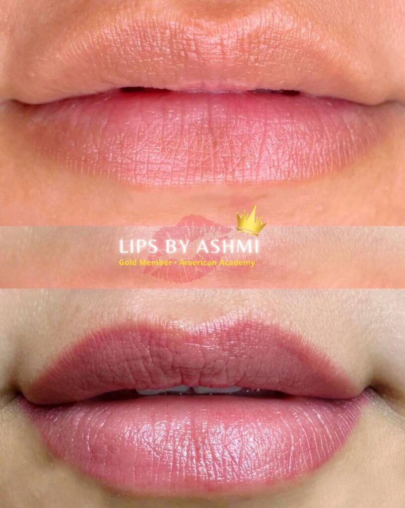 Best lip blush treatment in mumbai