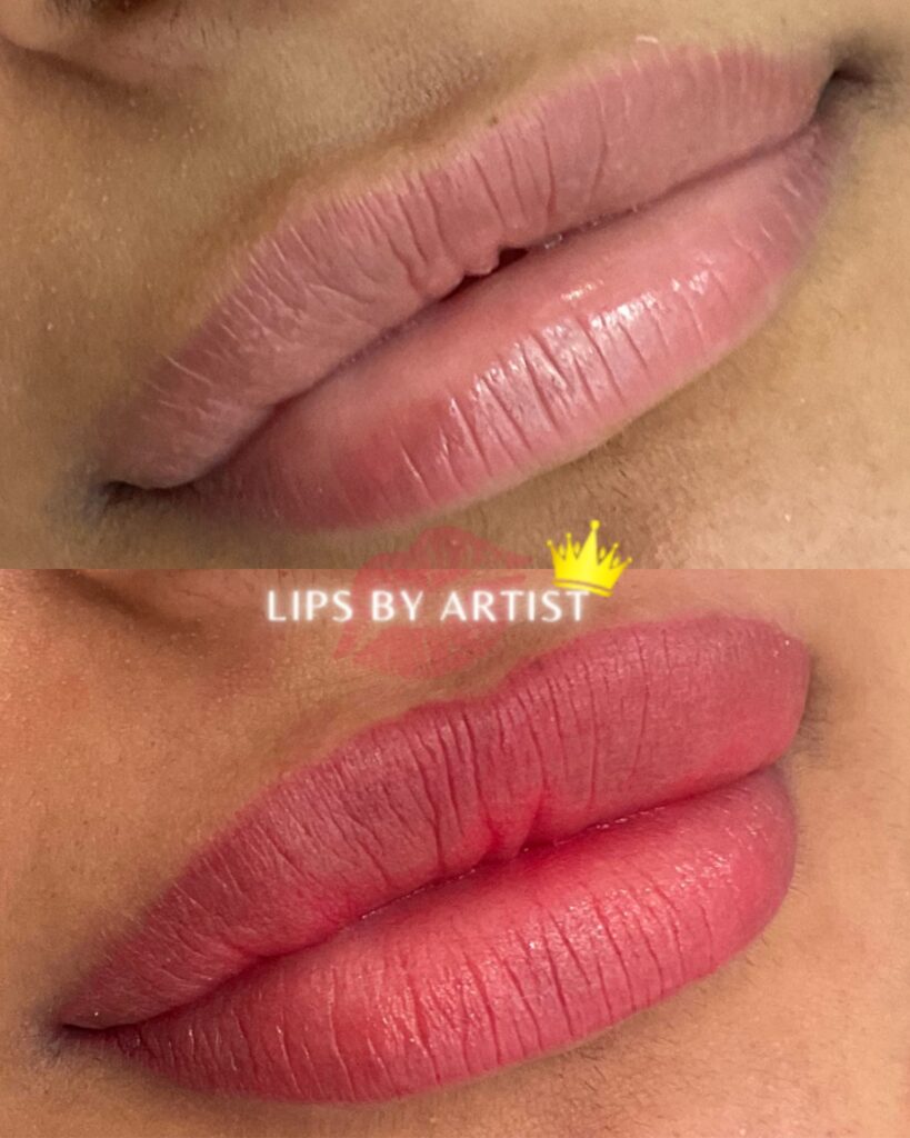 lip-blush-treatment