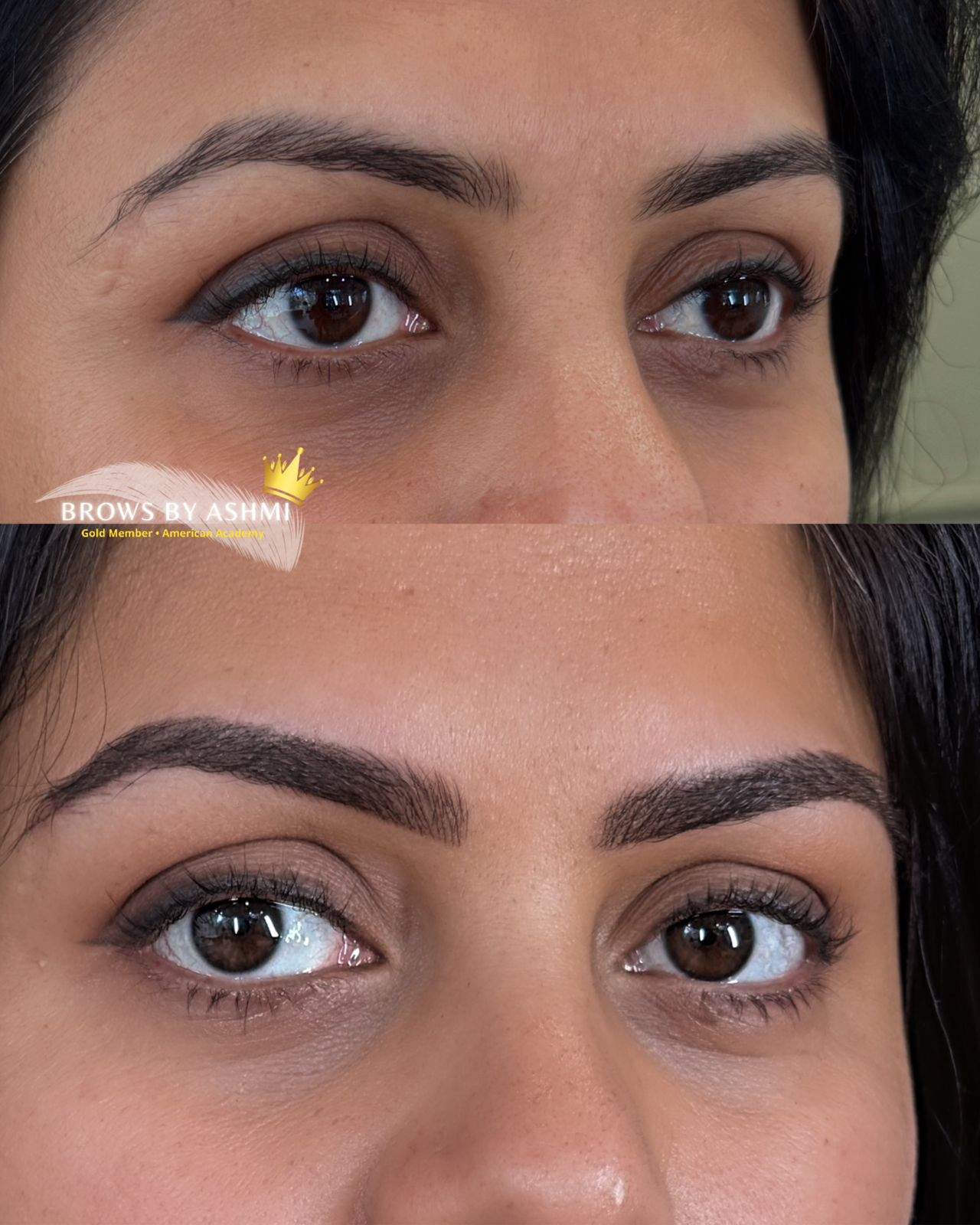 ashmeey-singhai-permanent-eyebrow-work