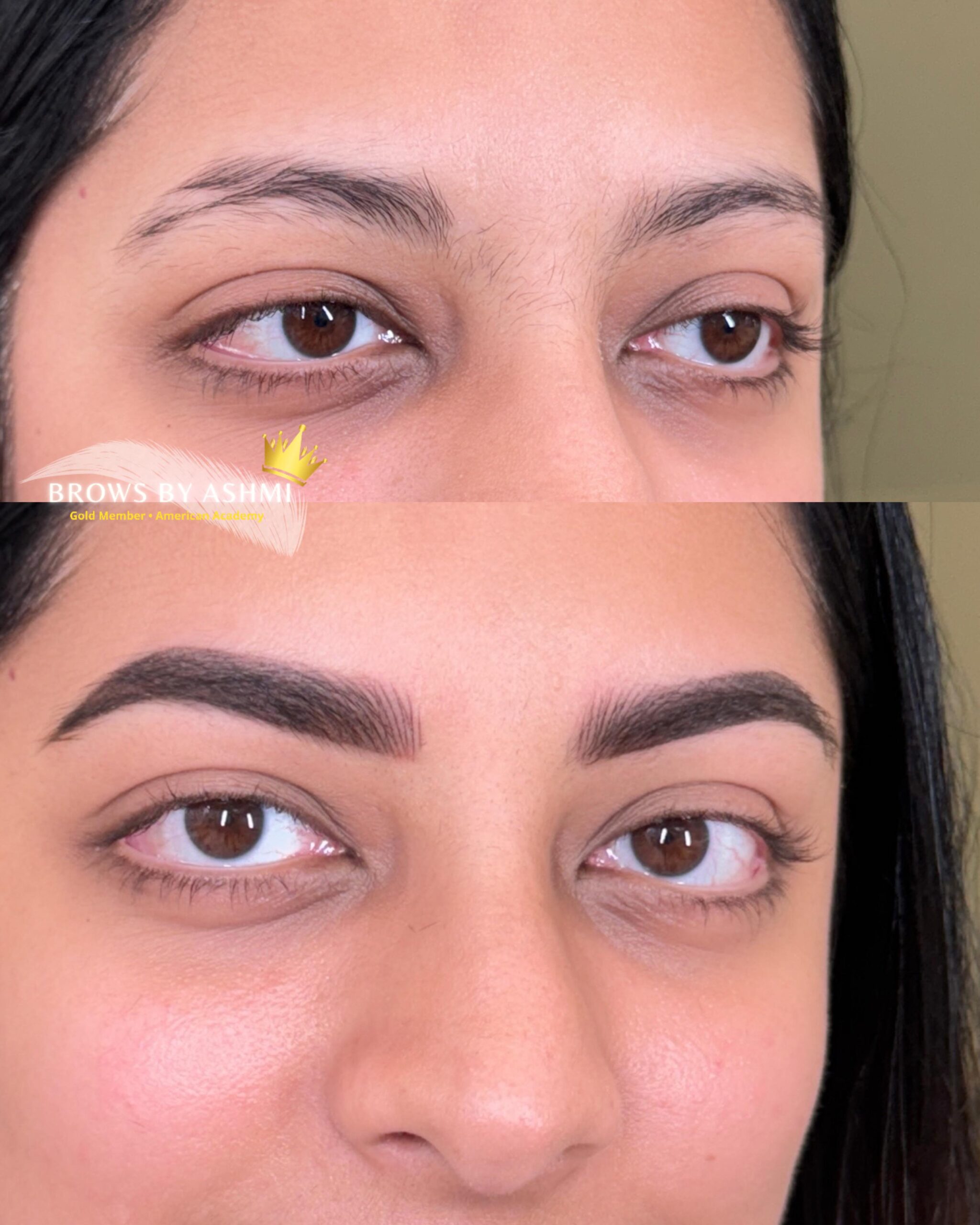 permanent-eyebrows-treatment-in-mumbai