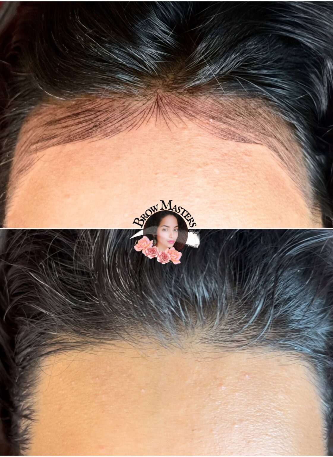 scalp-micropigmentation