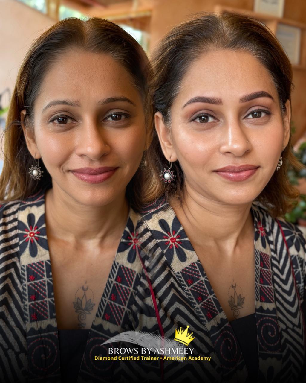 combination-brows-treatment