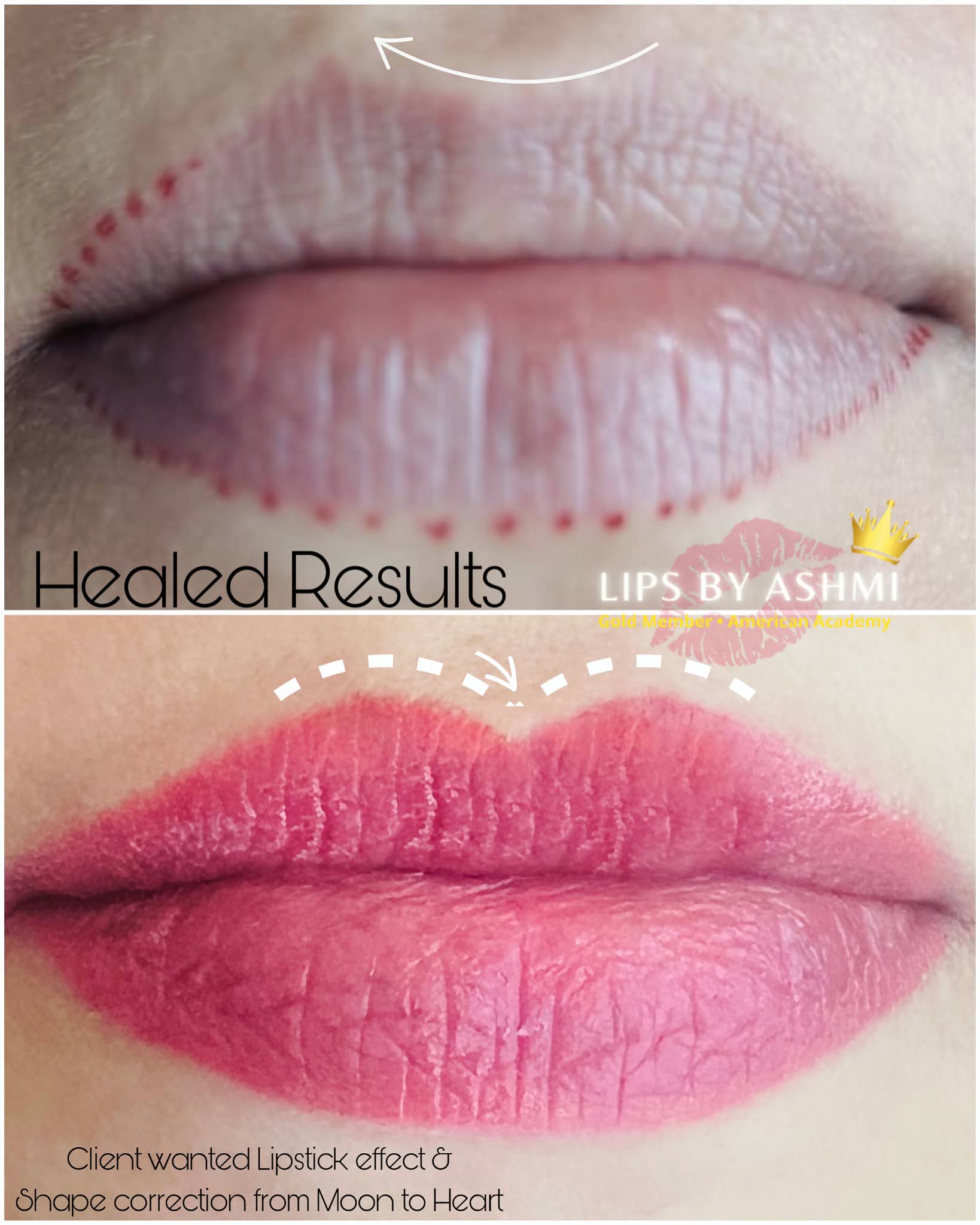 permanent-lip-blush