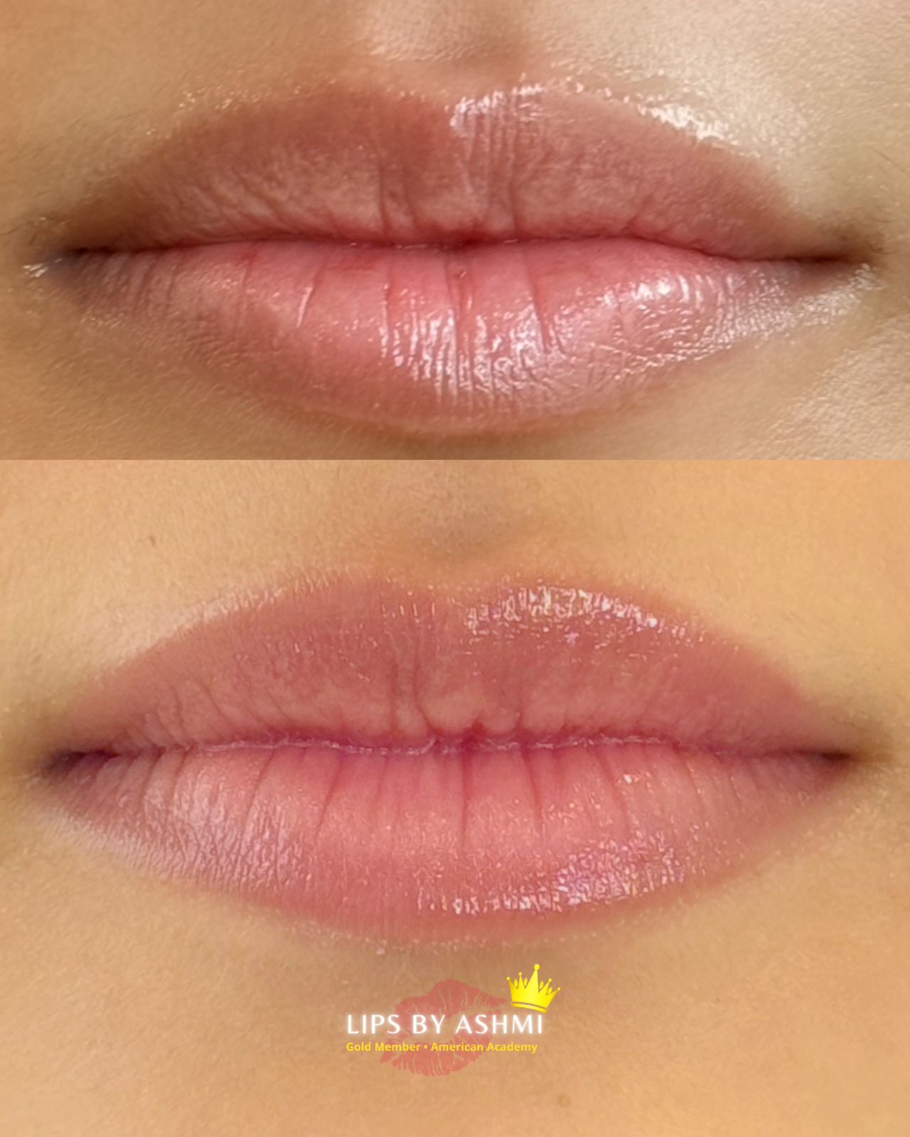 permanent-lip-tattoo